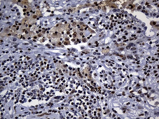 ALOX5 / 5-LOX Antibody (aa18-364, clone OTI1A1)