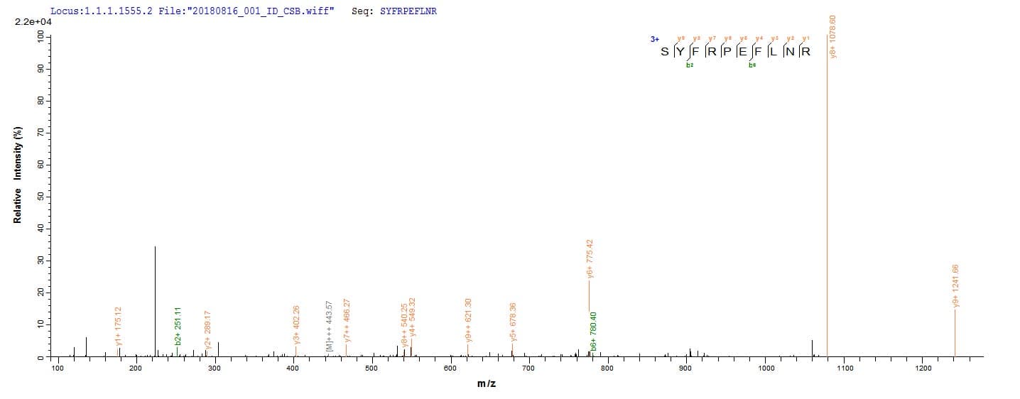 Trypanosoma cruzi HSP100 Protein (Recombinant 10His, N-terminus + Myc, C-terminus)