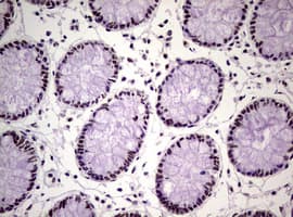 NBN / Nibrin Antibody (clone OTI6H7)