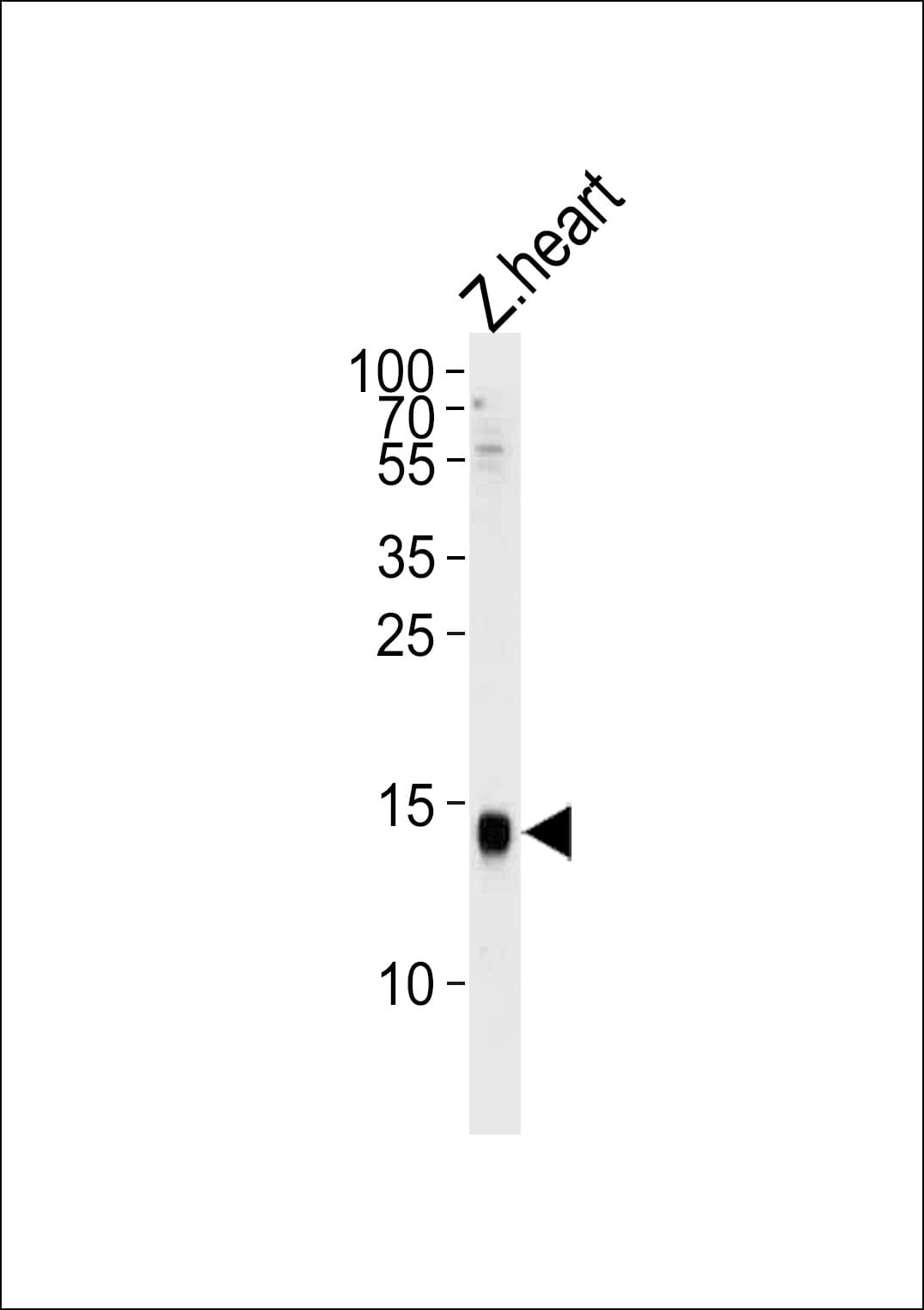 H2AFZ / H2A.z Antibody (aa59-86)