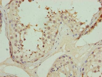 TRIP13 Antibody
