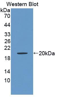 BAFF Receptor / CD268 Antibody (aa45-169)