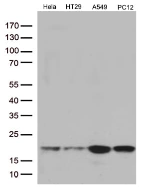 Monoclonal Mouse anti-Human TSEN15 Antibody (clone OTI5A3, Carrier-free, WB)