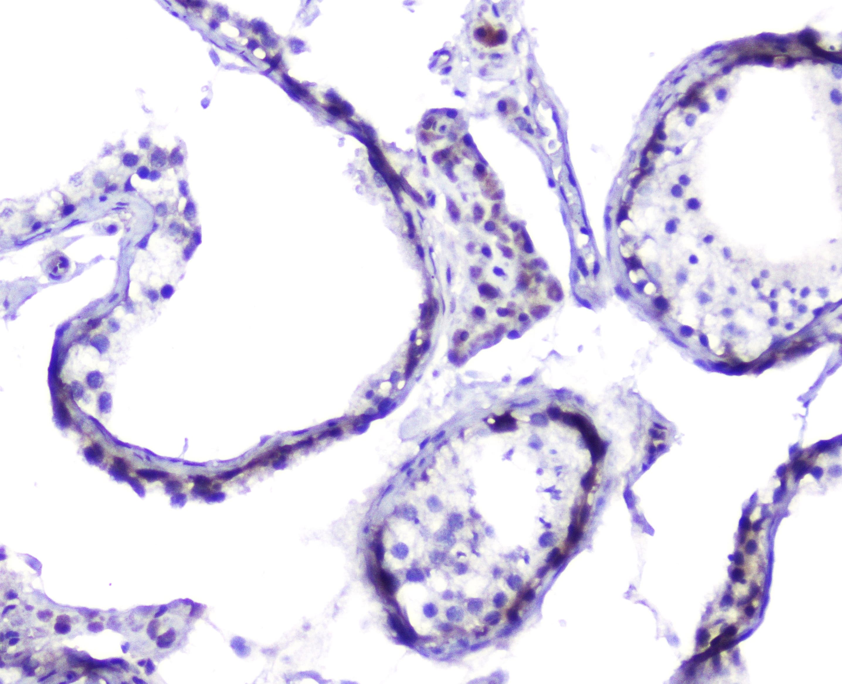 Polyclonal Rabbit anti-Human HSPH1 / HSP105 Antibody (IHC, WB)