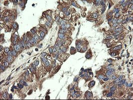 UBE2J1 Antibody (clone OTI3D1)