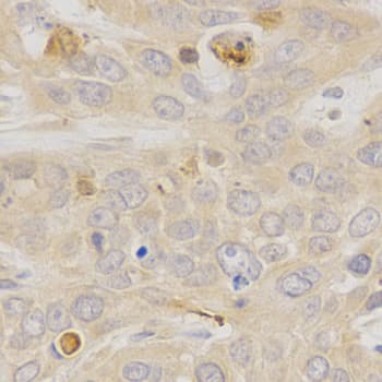 Polyclonal Rabbit anti-Human NR1A2 / THRB Antibody (IHC, WB)