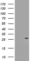 Monoclonal Mouse anti-Human NQO2 Antibody (clone OTI3A7, WB)
