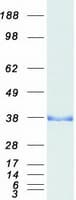 Human PPP1R1B / DARPP-32 Protein (Recombinant Myc-DDK (Flag))