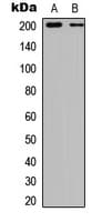 Tuberin / TSC2 Antibody (phospho-Ser939)