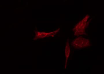 Polyclonal Rabbit anti-Human RPL3 / Ribosomal Protein L3 Antibody (IHC, IF, WB)
