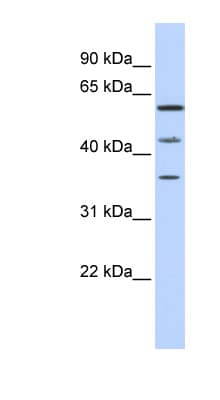 PHF23 Antibody (N-Terminus)