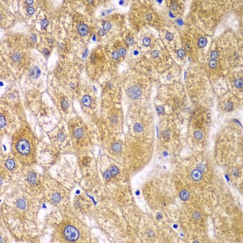 RPN1 / Ribophorin I Antibody