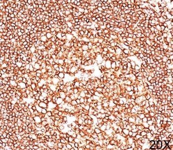 CD45 / LCA Antibody (clone 2B11, Ready-to-Use)