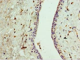 Polyclonal Rabbit anti-Human GPRC5A / RAI3 Antibody (aa258-357, IHC, WB)