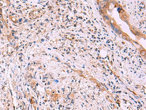 ZAP70 Antibody