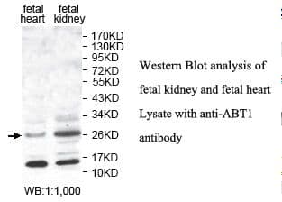 Polyclonal Rabbit anti-Human HABT1 / ABT1 Antibody (aa2-272, IHC, WB)
