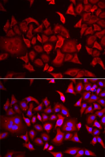 TARS Antibody