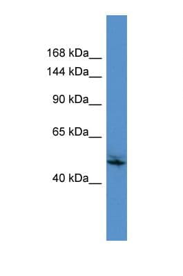 Polyclonal Rabbit anti-Human ZSCAN29 Antibody (C-Terminus, WB)