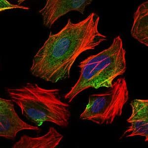 ACLY / ATP Citrate Lyase Antibody (Amino Acid: 306-502, clone 5F8D11)