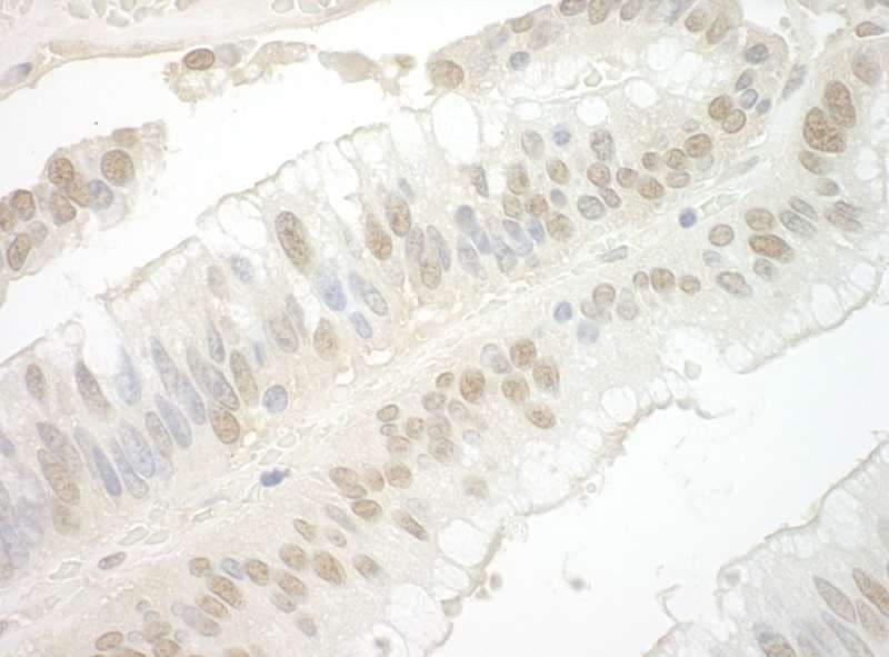 IHC-plus™ IPO7 / RANBP7 Antibody (aa200-250)