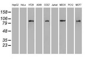 CTNNB1 / Beta Catenin Antibody (clone OTI2D11)