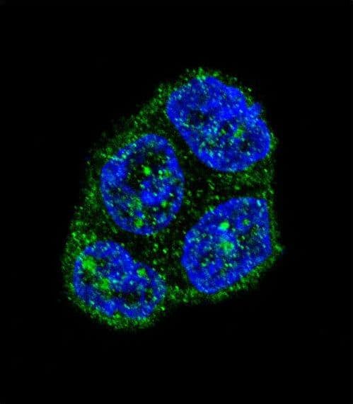 CD95 / FAS Antibody (aa185-211)