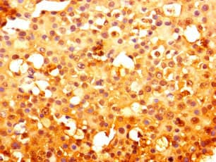 KF1 / RNF103 Antibody