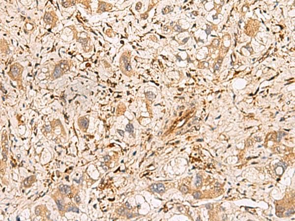 Polyclonal Rabbit anti-Human PLCB2 Antibody (IHC)