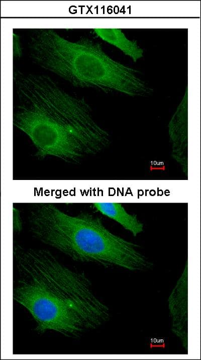 IHC-plus™ Polyclonal Rabbit anti-Human HRAS / H-Ras Antibody (aa111-189, IHC, WB)