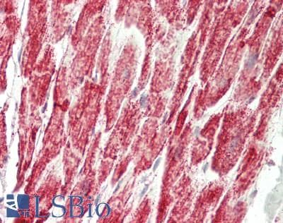 IHC-plus™ Polyclonal Rabbit anti-Human HADHB Antibody (IHC, IF, WB)
