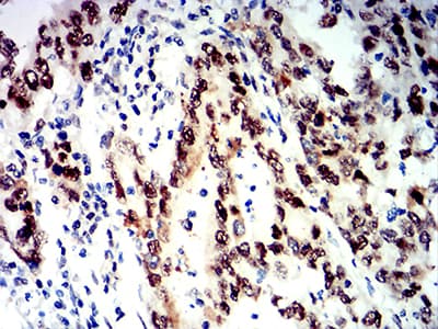 Monoclonal Mouse anti-Human SMARCA1 / SWI Antibody (clone 2H7B9, IHC, WB)