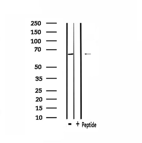 ADCK5 Antibody