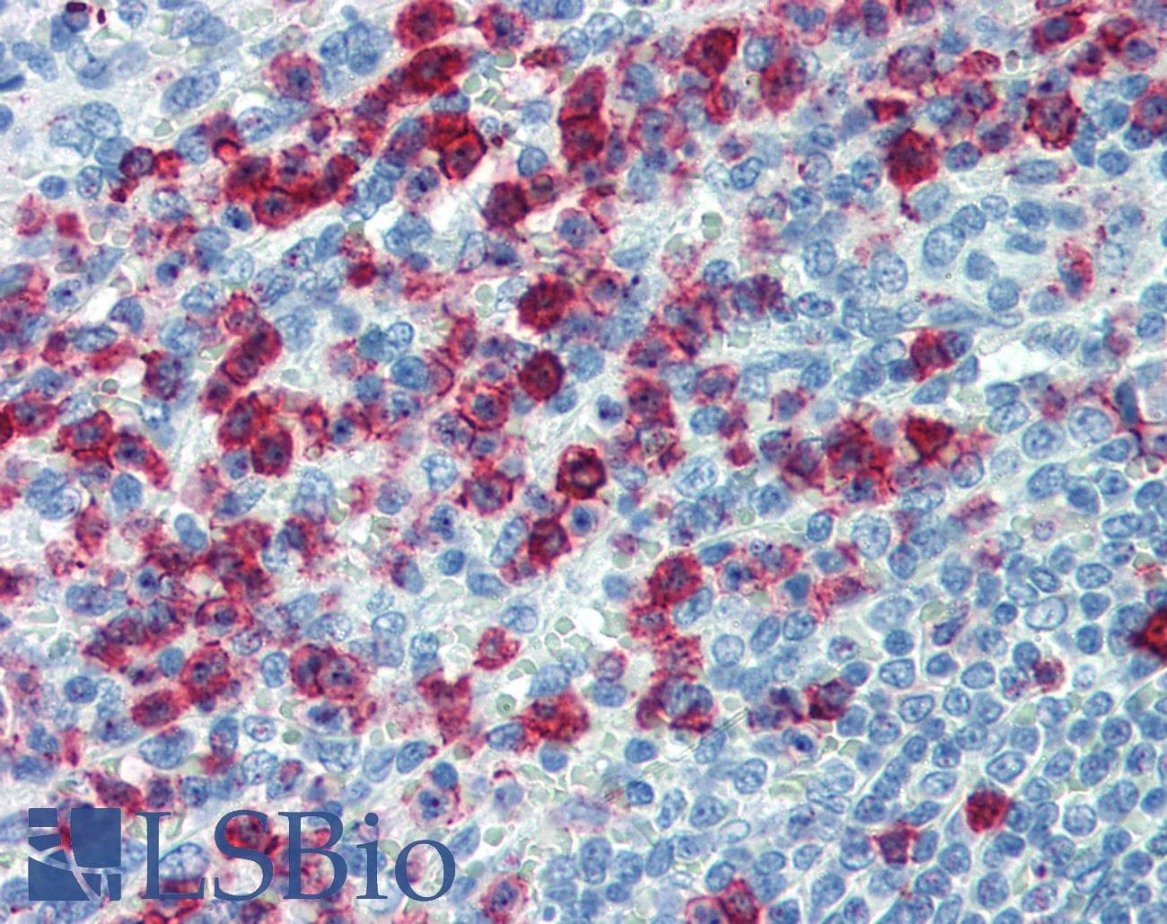 IHC-plus™ SELPLG / PSGL-1 / CD162 Antibody (clone HECA-452)