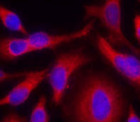 PRKD1 / PKC Mu Antibody