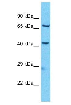 KBTBD11 Antibody (aa301-350)
