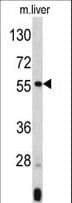 Polyclonal Rabbit anti-Human ANGPTL3 Antibody (aa82-114, WB)
