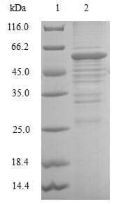 Human DHRS2 / HEP27 Protein (Recombinant GST, N-terminus)