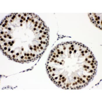 EWSR1 / EWS Antibody (aa369-399)