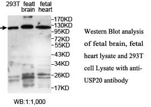 USP20 / VDU2 Antibody (aa2-217)