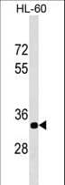 Polyclonal Rabbit anti-Human ERAL1 Antibody (aa152-180, WB)