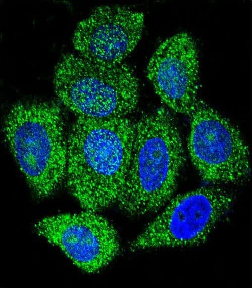 IHC-plus™ IMPDH1 Antibody (aa487-514)
