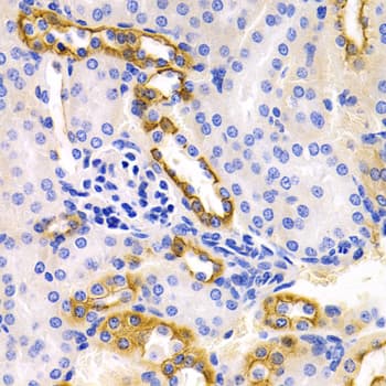 DRD1 / Dopamine Receptor D1 Antibody (aa338-446)