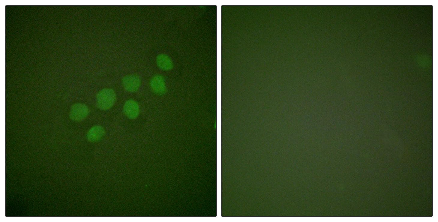 SKP2 Antibody