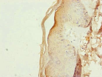Polyclonal Rabbit anti-Human RNF114 / ZNF313 Antibody (IHC, WB)