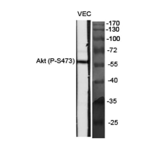 AKT1 Antibody (410-490 aa)