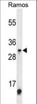 METTL1 Antibody (aa147-175)