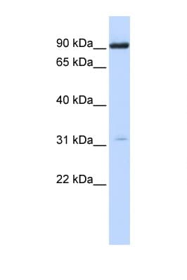 Polyclonal Rabbit anti-Human CHRNA4 / NACHR Antibody (N-Terminus, WB)