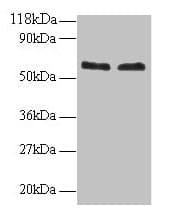 IHC-plus™ FUS / TLS Antibody
