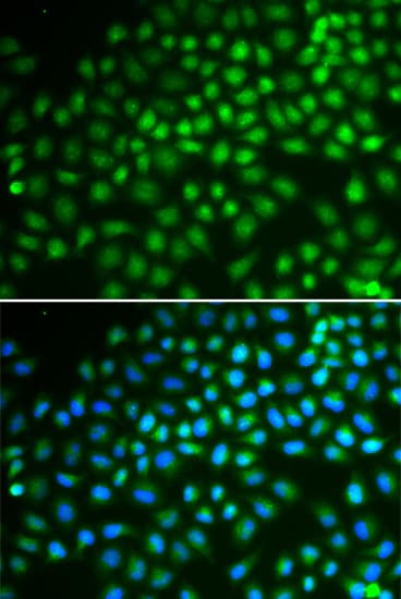 SMARCA5 / SNF2H Antibody