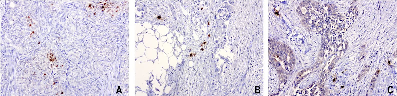 NKX3-1 Antibody (clone UMAB195)